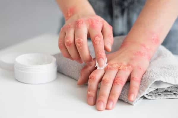 تصویر 2 از خرید کرم ضد آفتاب بی رنگ + قیمت فروش استثنایی